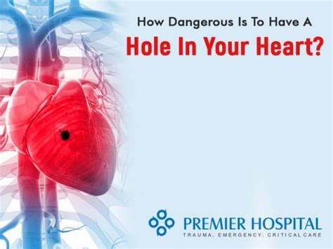 How Dangerous Is To Have A Hole In Your Heart Premier Hospital