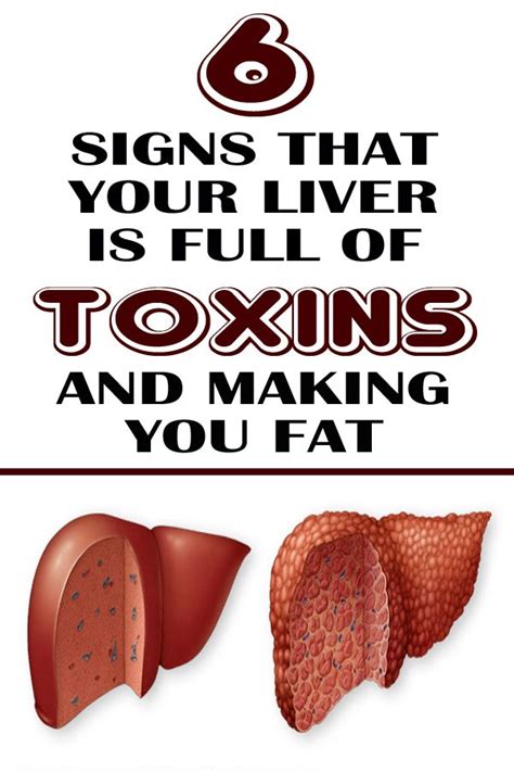 6 Signs That Your Liver Is Full Of Toxins Natural Health Care Health