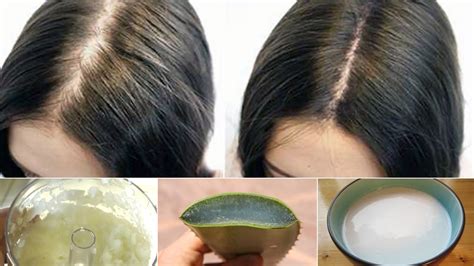 For coconut milk hair recipe: 6 Proven Home Remedies for Hair Loss - YouTube