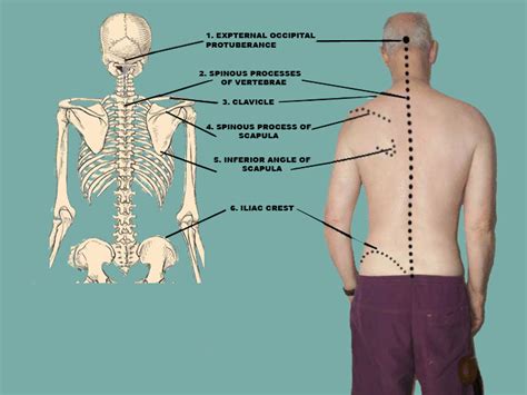 Superficial Back Landmarks