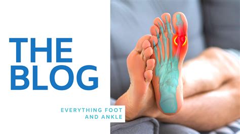 Blog Foot And Ankle Centers Of Frisco And Plano