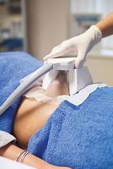Pictures of Fat Freeze Lipo Treatment