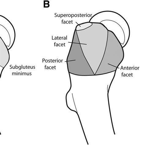 Pdf Partial Thickness Tears Of The Gluteus Medius Rationale And