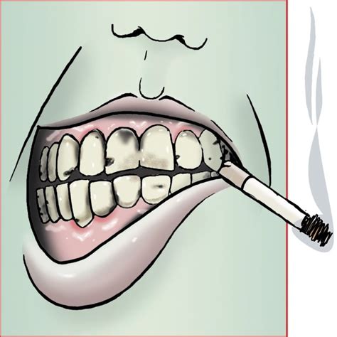 Smoking Prompts Tooth Decay Oral Cancer Article The United States Army