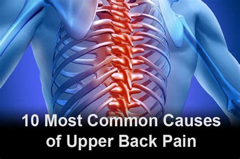 10 Most Common Causes Of Upper Back Pain Why Your Upper Back Hurts