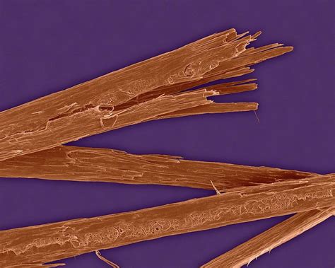 Human Hair With Split Ends Photograph By Dennis Kunkel