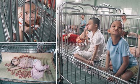 Agent Orange Children Suffer From Effects Of Vietnam War