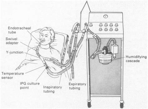 According to the definition offered by chatburn, a mechanical ventilator is an automated machine in which. Contamination of Mechanical Ventilators with Tubing ...