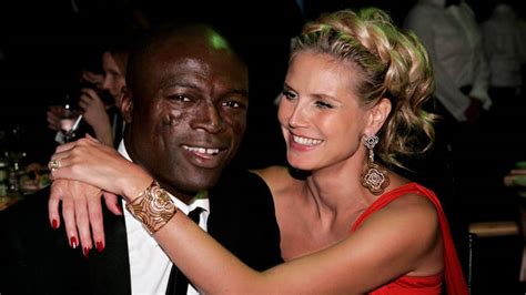 What We Know About Seal Face Scars A Look At His Medical History