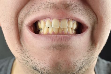 ways  whiten  teeth naturally  home man