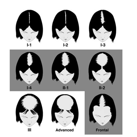 For hair loss, we typically use 5 million cell stem cell vials. Stem Cell Hair Growth Factors - PRP Injection Therapy ...