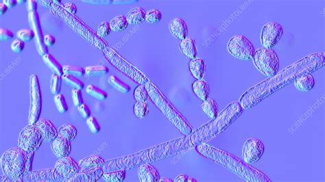 Trichosporon Fungus Illustration Stock Image F0360572 Science
