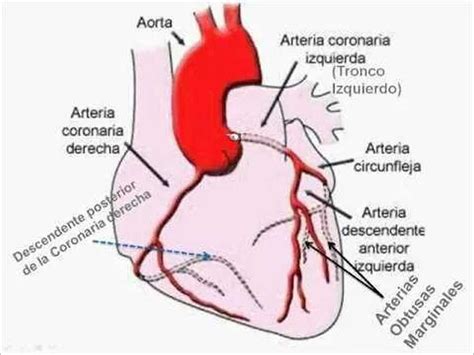 Esquema Arterias Coronarias