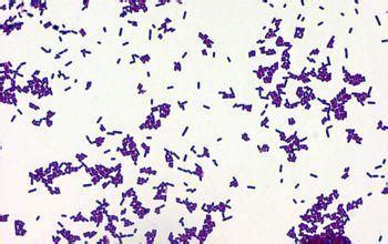 In animals, the bacteria can be shed in the milk and in cattle, the bacteria can cause mastitis and abortion. gram stain micro anaerobe and blood quiz at East ...