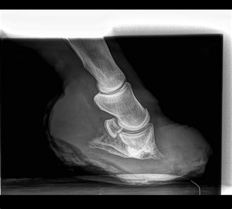 What Is Laminitis Or Founder In Horses And Why Is It So Dangerous