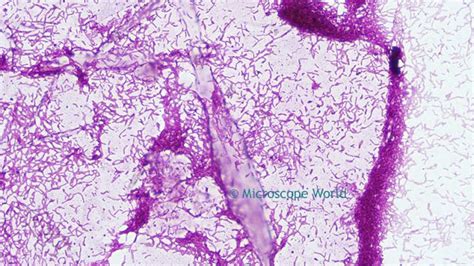 String is a database of known and predicted protein interactions. Rhodospirillum Rubrum (Bacteria) under Microscope ...