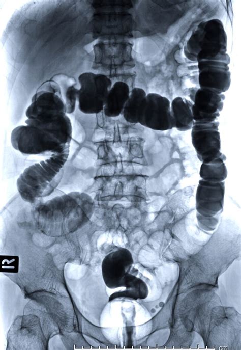 Computed Tomography Of The Abdomen Pelvis Radiology Associates Of Ocala Radiology Associates