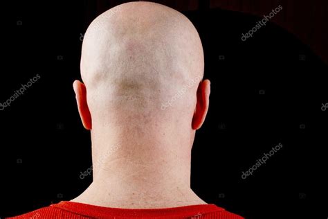 Bald Middle Aged Man Bald Head Middle Aged Man — Stock Photo