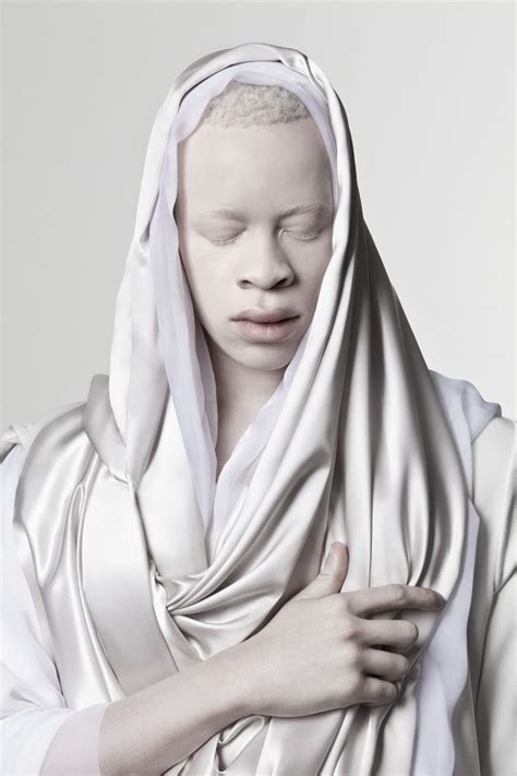 Justin Dingwalls Portfolio Albus Albino Model Albinism Albino