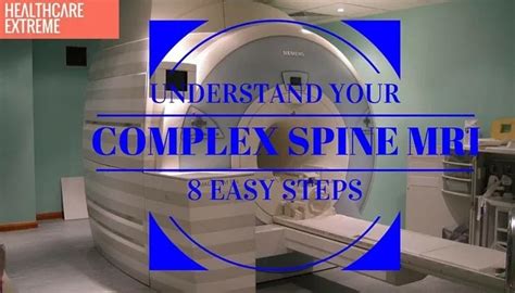 How To Understand Your Complex Spine Mri In 8 Easy Steps Healthcare