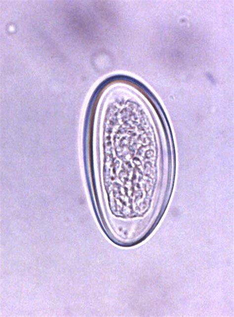 Enterobius Vermicularis Egg