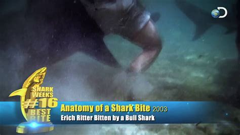 Shark Chomps Mans Leg Shark Weeks 25 Best Bites Shark Week 2012