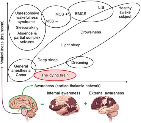 The Phenotypic Spectrum Of Disorders Of Consciousness Consciousness