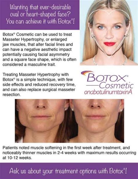 Masseter Botox Juverne