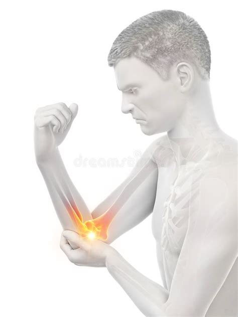 A Man With Painful Elbow Stock Illustration Illustration Of Medical