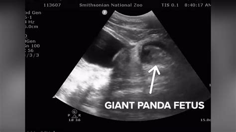 Giant Panda Mei Xiangs Ultrasound Shows Kicking Fetus Zoo Staff