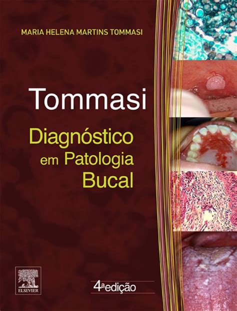 [download] diagnóstico em patologia bucal by antonio fernando tommasi and maria helena tommasi