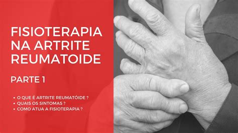 Fisioterapia Na Artrite Reumatoide Parte 1 YouTube