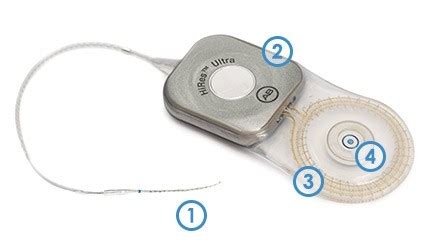 Internal Parts Of A Cochlear Implant Advanced Bionics
