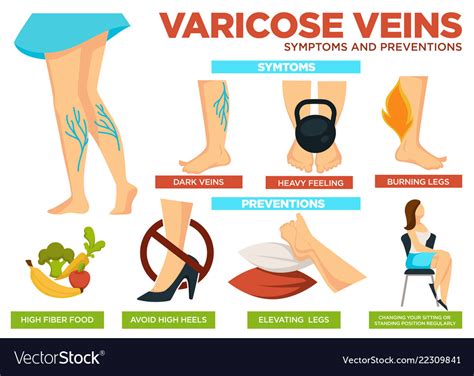 Varicose Veins Symptoms And Preventions Poster Vector Image