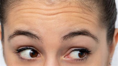 Tips Para Poder Eliminar Las Arrugas En La Frente De Forma Eficaz Belleza