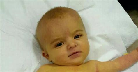Baby Who Turned Yellow After Getting Rare Liver Disease At Three Days