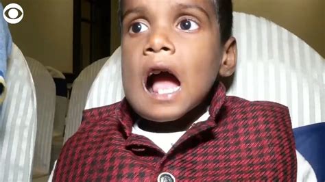 7 Year Old Boy Had 526 Teeth Removed From His Mouth