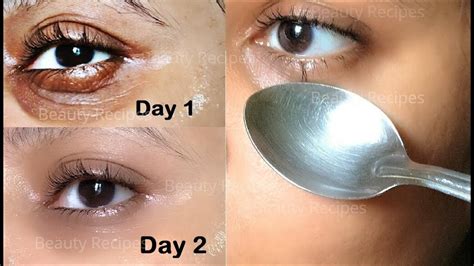 How To Remove Under Eye Wrinkles Under Eye Bags Puffy Eyes Dark Circles In Day With Ice