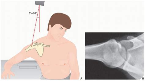 Upper Limb I Shoulder Girdle Radiology Key