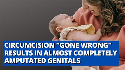 Circumcision Gone Wrong Results In Almost Completely Amputated Genitals