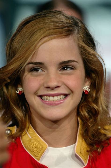 Emma Watson Braces