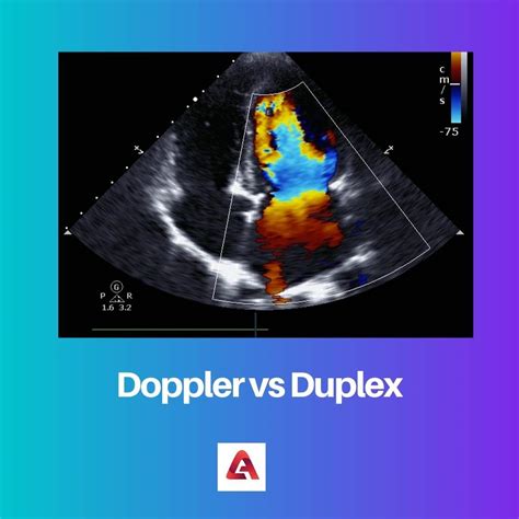 Doppler Vs Duplex Difference And Comparison