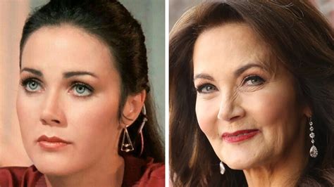 Lynda Carter Facelift Plastic Surgery Before And After Cloudyx Girl
