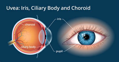 Check spelling or type a new query. Retina, Vitreous & Uvea - Netra Darshan Eye Hospital