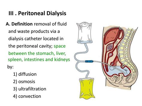 Exploring Peritoneal Dialysis At Dekalb Hillandale A Comprehensive