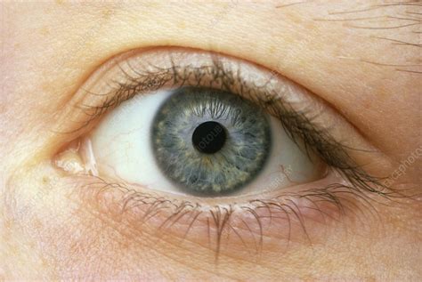 Womans Right Eye With Pupil Slightly Contracted Stock Image P420