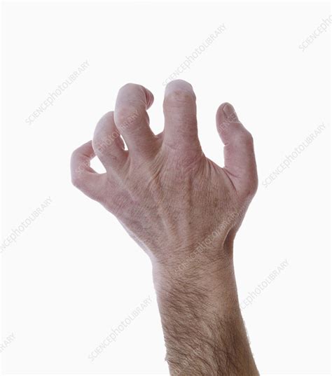 Dorsum Of The Human Left Hand Stock Image C0127354 Science Photo