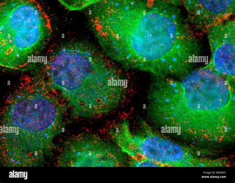 Supertough Cancer Cells Microscopic View Stock Photo Alamy