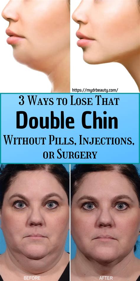 How To Get Rid Of Double Chin Without Surgery Pacific Alliance News