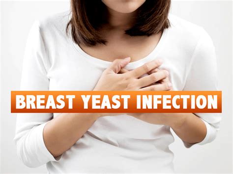Breast Yeast Infection Causes Symptoms Risk Factors Treatments And